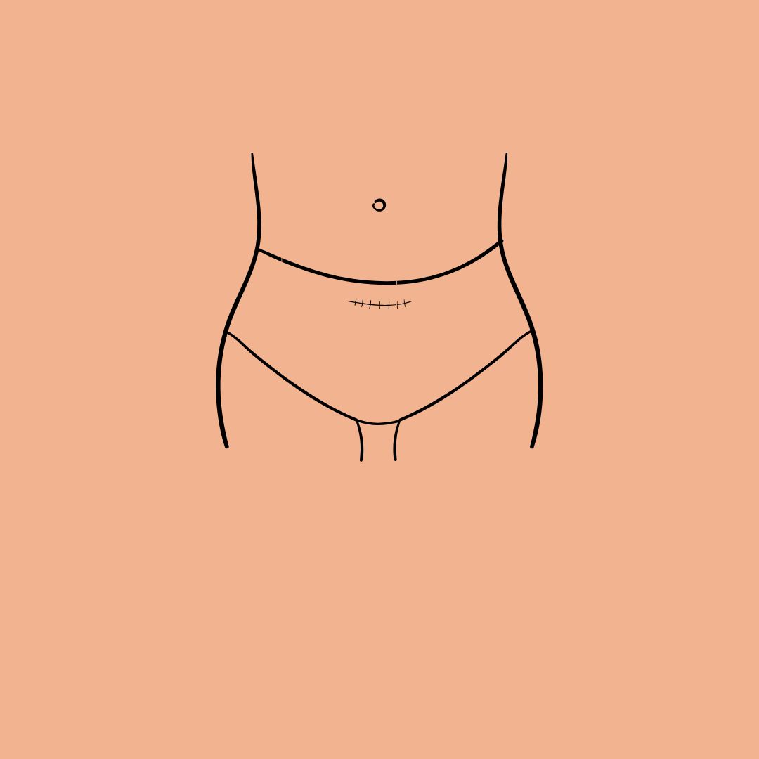 project-thumb